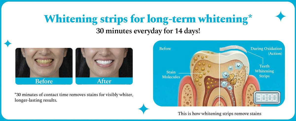 Perfora™ Teeth Whitening Strips For Teeth Mint Flavour 7 Pairs (14 Strips)